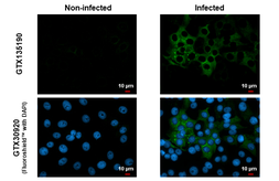 Anti-Chikungunya virus nsP4 antibody used in Immunocytochemistry/ Immunofluorescence (ICC/IF). GTX135190